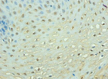 TEP1 Antibody