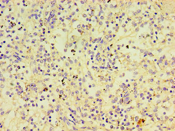 PTPN5 Antibody