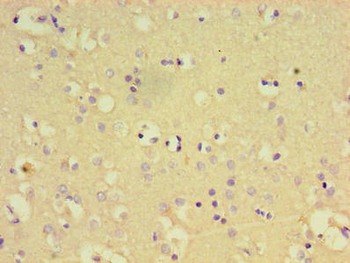 PTPN5 Antibody