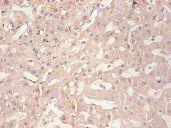 FTL Antibody