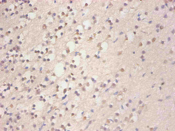 FTL Antibody