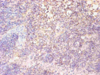 FTL Antibody