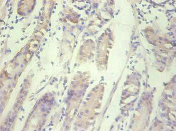 CXCL8 Antibody