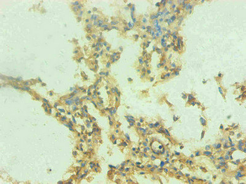 S100A9 Antibody