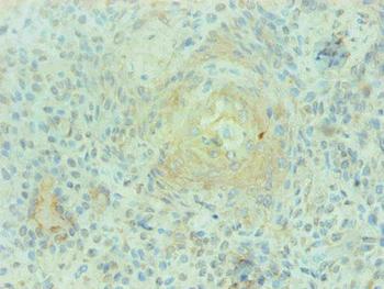 S100A9 Antibody