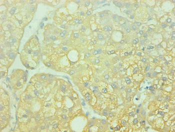 AHSG Antibody