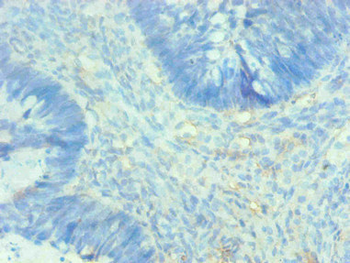 AHSG Antibody