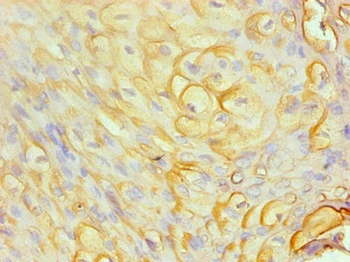 S100A8 Antibody