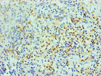 S100A8 Antibody