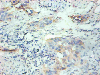 FABP3 Antibody