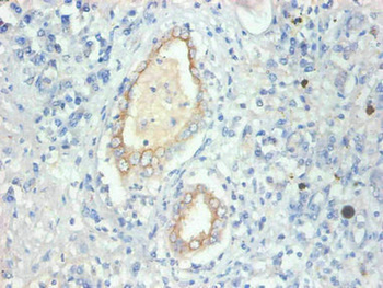 FABP3 Antibody