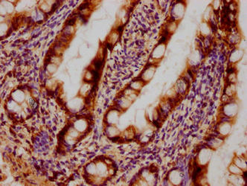LGALS3 Antibody
