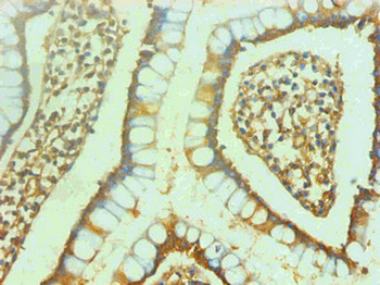 ENO2 Antibody