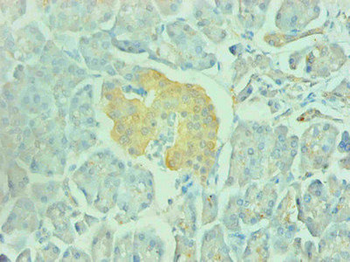 ENO2 Antibody