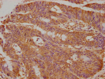 TFF3 Antibody