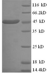 Human ACAA2 protein