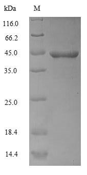 Human ACTA1 protein
