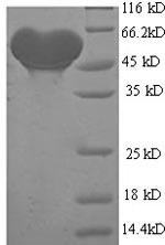 Human ADH1B protein