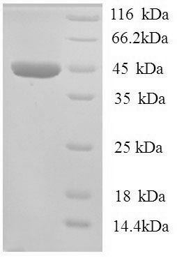 Human ADH7 protein