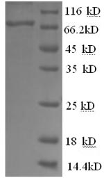 Mouse Alpha 1 Feto protein