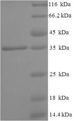 Human AGA protein