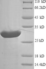 Human AGRP protein