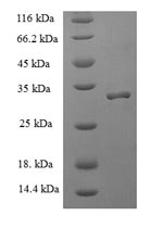 Human AIF1 protein