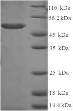 Human AKR1C2 protein