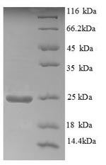 Human AOX1 AO protein