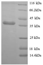 Mouse Apolipoprotein E protein