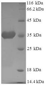 Human ARF6 protein