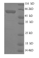 Human ART1 protein