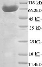 Mouse Atp5b protein