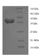 Human ANAPC15 protein