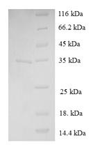 Human IMUP protein