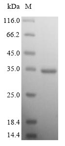 Human CACNA2D1 protein