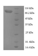 Human CASR protein
