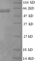 Human CBS protein