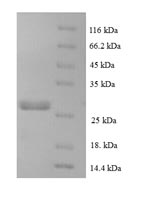 Human CCL16 protein