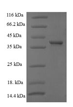 Human CCND1 protein