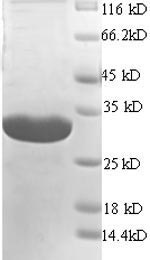 Mouse Cd74 protein