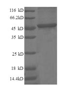 Human CDKN1A protein