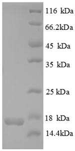 Human CDKN2AIPNL protein