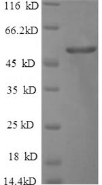 Human CDR2 protein