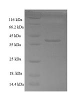 Human CNN3 protein