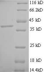 Human CPA3 protein