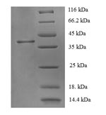 Human CRHR1 protein