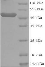 Human CSNK1E protein