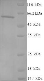Human CSNK2A1 protein