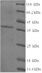 Human CSRP3 protein